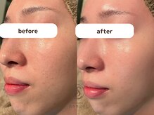 サンゴ(Sango)の雰囲気（結果重視のサロンケアで理想のお肌に♪根本改善を目指します★）