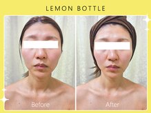 シロカネ 光の森店(SHIROKANE)/レモンボトル☆