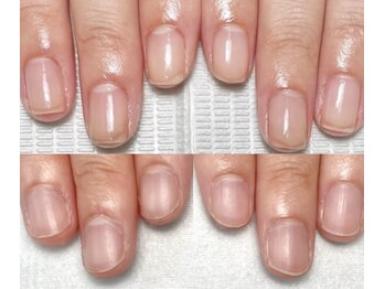 自爪育成/最強ネイルケア