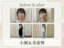 やえざきカイロプラクティックの雰囲気( ★平塚駅西口徒歩2分! 小顔&骨盤・姿勢整体専門院!)
