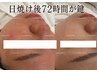 \ 日焼け後72時間が鍵 / 肌リカバリーケア |70分