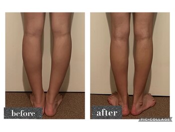 マンダ 田町(Manda)/骨盤矯正でまっすぐな脚に◎