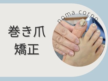 ノーマコルポ(noma corpo)/痛み改善!!【巻き爪矯正】