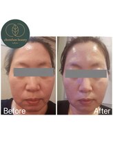 チョンダムビューティー(chondam beauty)/たるみケア&水光ケアでツヤ美肌