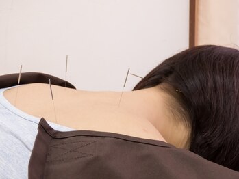 ライズボディ(Rise Body)/整体+鍼でツラいお悩みも解消