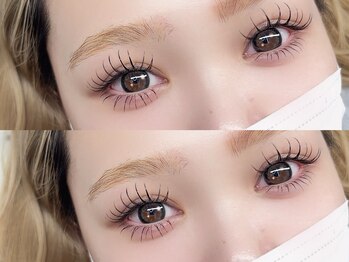 ソア(soa.)/LED上下(Haruka施術)