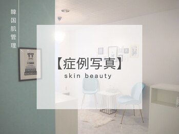 ベル 那覇おもろまち(Belle)/お客様のBefore|After