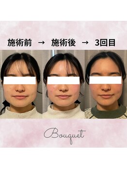 ブーケ(Bouquet)/ブライダルプランあり