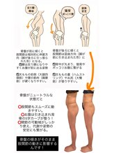 エミナル(EMINALu)/骨盤とぽっこりおなか