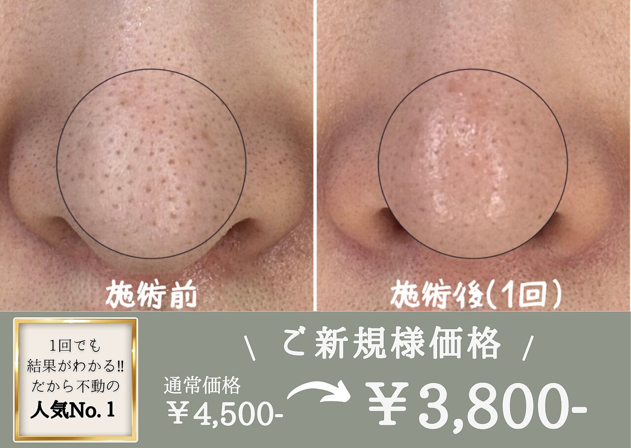 綺華(Ayaka)｜ホットペッパービューティー