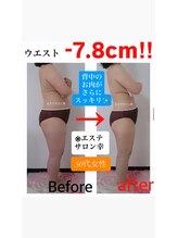 エステサロン 幸/50代　ウエスト　-7.8cm