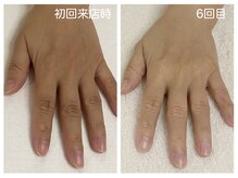 キレイテ 上野店/40代/6回目【ハンドケア稲荷町】