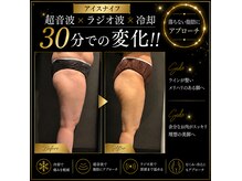 アッヴェリーレ(A'bbellire)