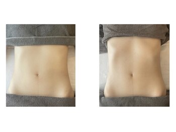 ユニ 下北沢駅前店(Uni)/腸セラピー