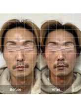 小顔整体 優/バランスが整うとイケメン度up