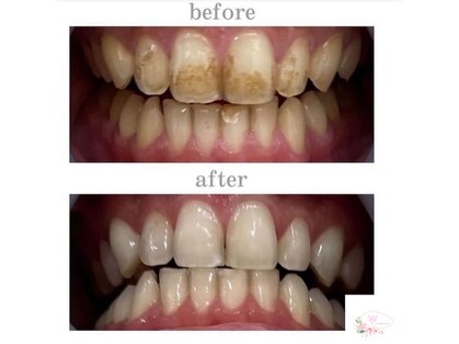 ホワイトニングショップ 本厚木店の写真