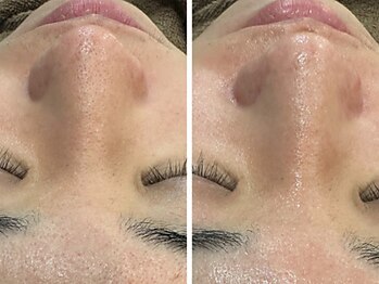 ケアナ 梅田店(CareNa)/メンズの清潔感ここにあり