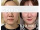 ソワラ(Soiela)の写真/小顔を目指すなら表情筋筋トレ!シミ対策も◎初めての方でもリラックスできる空間で美肌体験を☆