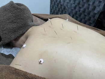 オレンジフラワープラス(orangeflower+)/肩甲骨がガチガチの方に