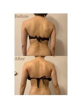 グランディール(GRANDIR)/【痩身】上半身コース3回