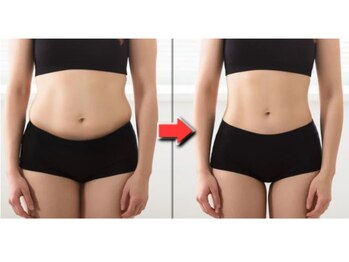 イストアールエム(HISTOIRE.M)/辛いダイエットはもう終わり！