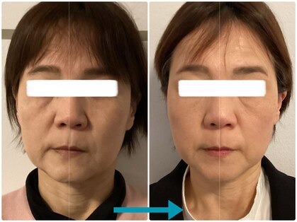 フェイシャルヒーロー 大阪北堀江店(Facial Hero)の写真