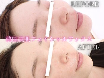 レイネ(REINE)/毛穴・美白ケア◎韓国美肌WAX