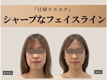 オーク ナチュリ 成城学園前(OAK×NACHUL)/口もとすっきり!きれいなVライン