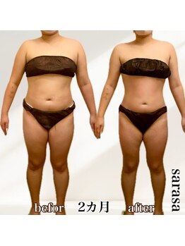 ナチュラル ビューティー スタイル さらさ(Natural Beauty Style)/さらさ痩身プログラム2カ月