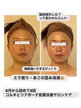 パル コルギサロン(Pal. Korugi salon)/コルギビフォーアフター