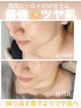 シエロ(Cielo)/ピカピカツヤ肌なら陶肌ピール