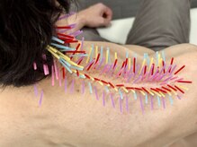 とだ鍼灸院の雰囲気（【首肩こり☆呼吸☆いかり肩】うつむき姿勢！トリガー鍼で楽に♪）