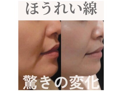 Nビューティーの写真