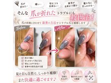 アンドネイルアンドビューティー(&NAIL and Beauty)/亀裂補修やネイルトラブル対応