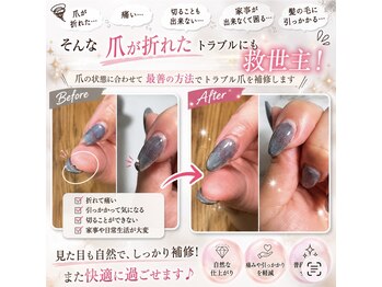 アンドネイルアンドビューティー(&NAIL and Beauty)/亀裂補修やネイルトラブル対応