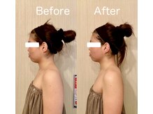 サロン ド シャルール/フェイシャルで華奢美人