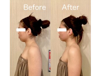 サロン ド シャルール/フェイシャルで華奢美人