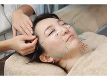 フィーマリー 代官山店(femally)/【美容鍼灸】