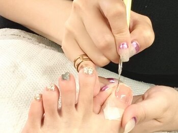 カーム(CALM)の写真/伊敷ネイルサロン/駐車場有!爪のお悩みは当店にお任せ,巻き爪ケアの資格を持つスタッフがケアします