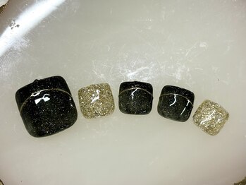 エスディーアイ(SDI)/フット 定額シンプル