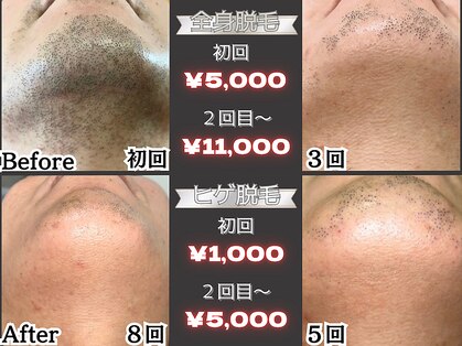エクレ 今池店(EKURE)の写真