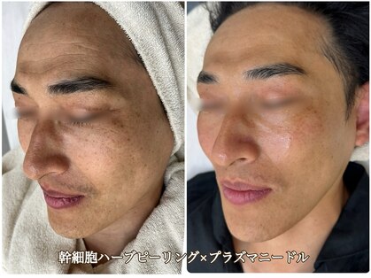 イロハ(IROHA)の写真