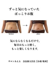 サロンあえる 新大宮店/気になっているぽっこりお腹