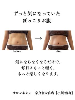 サロンあえる 新大宮店/気になっているぽっこりお腹