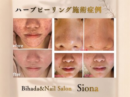 シオナ(Siona)の写真