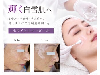 ル シーニュ 豊田市の写真/【メイク直しで、直しきれない】ファンデを重ねれば重ねるほど、綺麗に見えないお悩みに。