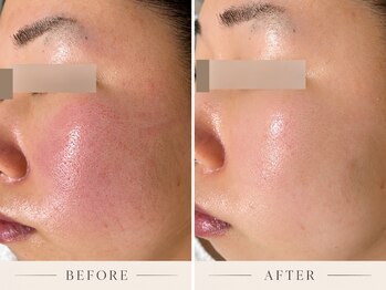 ピュウリリアーナ(Piu liliana)の写真/切らない、入れない。流行に流されず、素肌本来の美しさを引き出すPIU LILIANAの本格肌管理
