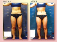 ジュリア オージェ 京橋店/ビフォーアフター（ターゲット)