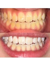 ライトビューティー 池袋店(LightBeauty)/症例写真