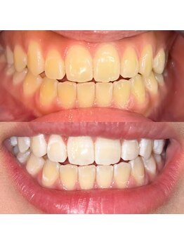 ライトビューティー 池袋店(LightBeauty)/症例写真